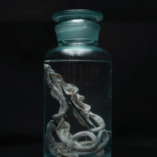 Выставка «Паразиты. Те, кто живут внутри»